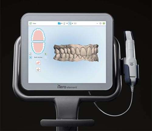 Invisalign 3D Scanning